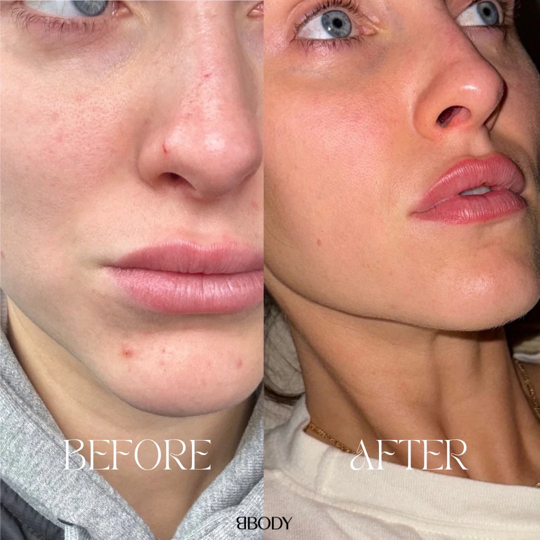 TRIPEPTIDOVÝ KOLAGÉN S VITAMÍNOM C - BBODY